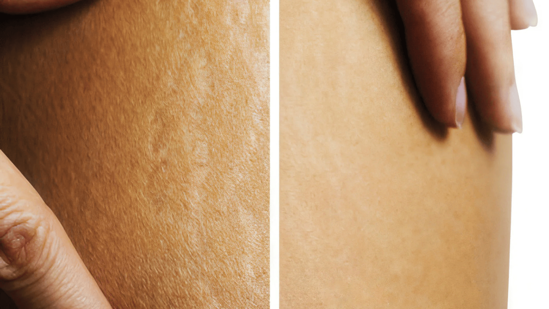 Healed PMU Results